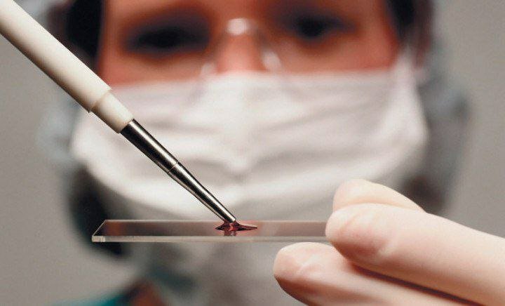 ️Mutaxassis: Qon quyuqlashishi insult va infarkt xavfini oshiradi