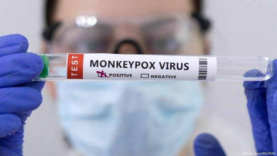 В стране может быть объявлена ​​чрезвычайная ситуация с оспой обезьян