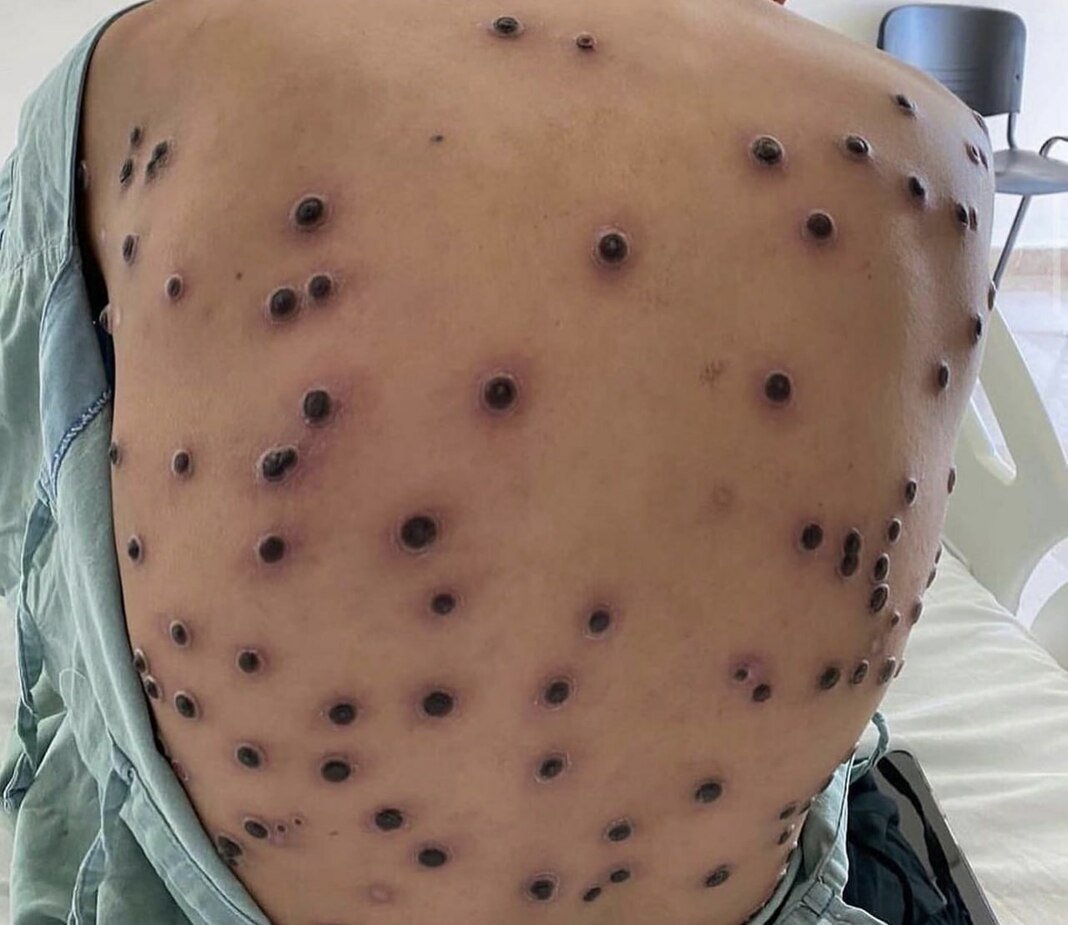 Qiz va maymun ortasidagi jinsiy aloqa galereyasi Qiz va maymun ortasidagi jinsiy aloqa galereyasi