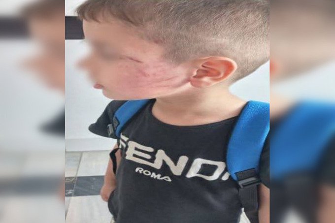Buxorodagi bogʻcha tarbiyalanuvchilaridan birining otasi boshqa bir bolani urdi