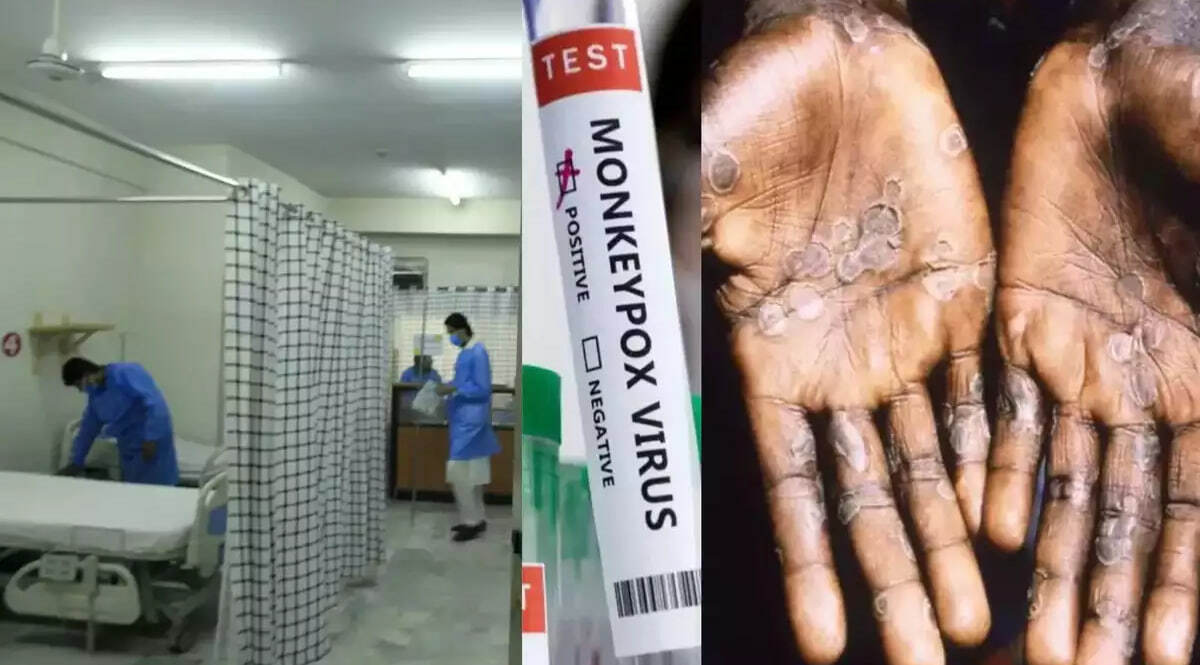 Avgust oyida dunyoda 2 082 ta yangi mpox bilan kasallanish holatlari qayd etildi