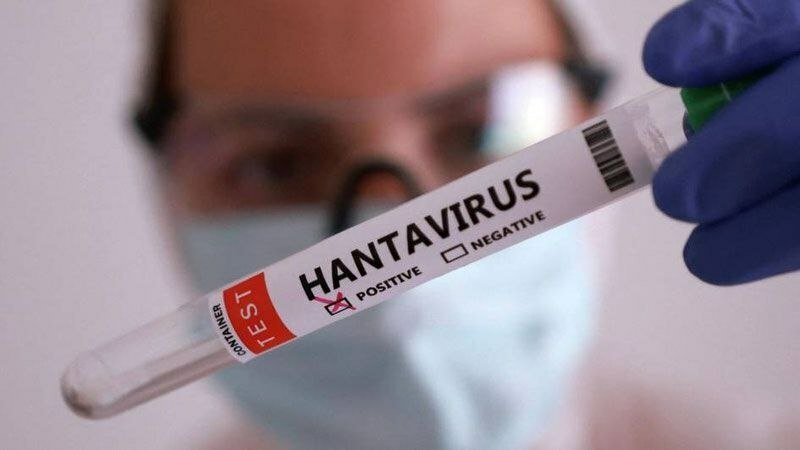 Hantavirusning O‘zbekistonda ham tarqalish ehtimoli bormi?