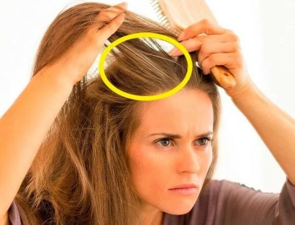 Почему волосы рано седеют?