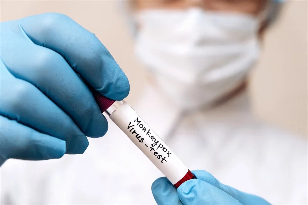 O‘zbekistonga maymunchechakni aniqlovchi test tizimi keltiriladi