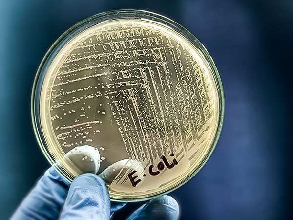 Bakteriyalarga qarshi vosita: Yangi tabiiy antibiotik yaratildi